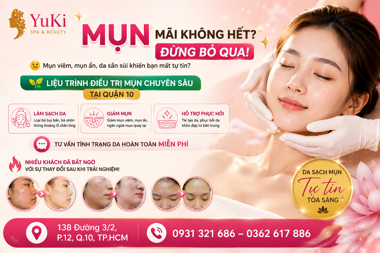 điều trị mụn quận 10